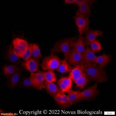 Immunocytochemistry/Immunofluorescence: CD47 Antibody (B6H12.2) - Azide Free [NBP2-31106] - A431 cells were fixed in 4% paraformaldehyde for 10 minutes and permeabilized in 0.05% Triton X-100 in PBS for 5 minutes. The cells were incubated with CD47 Antibody [B6H12.2] conjugated to Biotin (NBP2-31106B) at 5 ug/ml for 1 hour at room temperature then detected with Streptavidin conjugated to DyLight 550. Nuclei were counterstained with DAPI (Blue). Cells were imaged using a 40X objective.