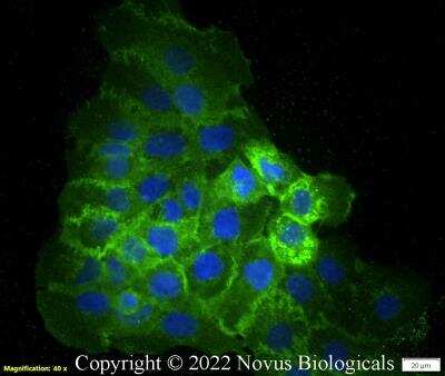 Immunocytochemistry/Immunofluorescence: CD47 Antibody (B6H12.2) - Azide Free [NBP2-31106] - A431 cells were fixed in 4% paraformaldehyde for 10 minutes and permeabilized in 0.05% Triton X-100 in PBS for 5 minutes. The cells were incubated with CD47 Antibody [B6H12.2] (NBP2-31106) at 1 ug/ml overnight at 4C and detected with an anti-mouse Dylight 488 (Green) at a 1:1000 dilution for 60 minutes. Nuclei were counterstained with DAPI (Blue). Cells were imaged using a 40X objective.