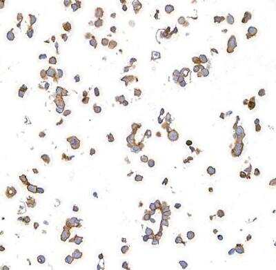 Immunocytochemistry: CD47 Antibody (BLR131H) [NBP3-14713] -  Whole cell lysate (2 ug) from Jurkat, RKO, GaMG, U2OS, OVCAR-3, HeLa, HEK293T, and A-549 cells prepared using NETN lysis buffer. 