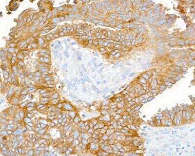 Immunohistochemistry: CD47 Antibody (BLR131H) [NBP3-14713] -  Whole cell lysate (2 ug) from Jurkat, RKO, GaMG, U2OS, OVCAR-3, HeLa, HEK293T, and A-549 cells prepared using NETN lysis buffer.  secondary  Rabbit anti-CD47 recombinant monoclonal antibody used at 1:1000. 