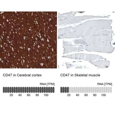 Immunohistochemistry-Paraffin: CD47 Antibody (CL6913) [NBP2-76511] - Analysis in human cerebral cortex and skeletal muscle tissues. Corresponding CD47 RNA-seq data are presented for the same tissues.