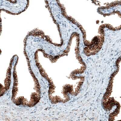 Immunohistochemistry-Paraffin: CD47 Antibody (CL6913) [NBP2-76511] - Staining of human prostate shows strong membranous positivity in glandular cells.