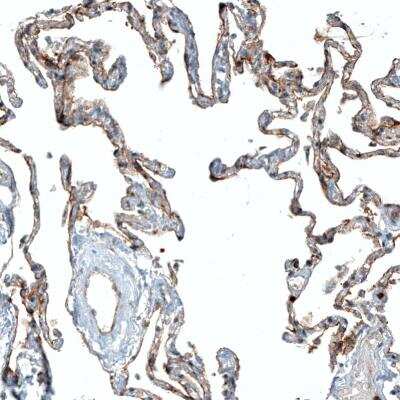 <b>Orthogonal Strategies Validation. </b>Immunohistochemistry-Paraffin: CD47 Antibody (CL6913) [NBP2-76511] - Staining of human lung shows moderate membranous positivity in pneumocytes.