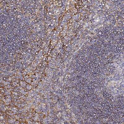 Immunohistochemistry-Paraffin: CD47 Antibody [NBP2-32031] - Staining of human tonsil shows moderate membranous positivity in non - germinal center cells.