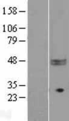 Western Blot CD47 Overexpression Lysate