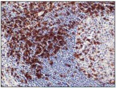 Immunohistochemistry-Paraffin: CD5 Antibody (A25-G) [NBP1-78994] - Formalin-fixed and paraffin-embedded human tonsil tissue (4 um) stained with anti-CD5 antibody shows strong positive immunostaining of T-lymphocytes.Kindly performed and provided by Katarina Poliakova, MD and Lubomir Straka, MD, Ph. D. from Clinical Pathology Presov, Ltd., Presov, Slovak republic.