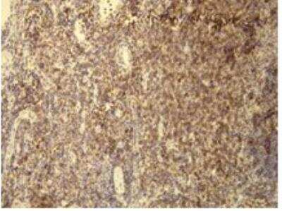 Immunohistochemistry-Paraffin: CD5 Antibody (A25-G) [NBP1-78994] - CD5 positive T-lymphocytes of the lymph node. Formalin fixed, paraffin embedded human tissues (4 um sections) stained with anti-CD5 monospecific clonal antibody.