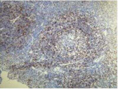 Immunohistochemistry-Paraffin: CD5 Antibody (A25-G) [NBP1-78994] - CD5 positive T-lymphocytes of the palatine tonsil. Formalin fixed, paraffin embedded human tissues (4 um sections) stained with anti-CD5 monospecific clonal antibody.