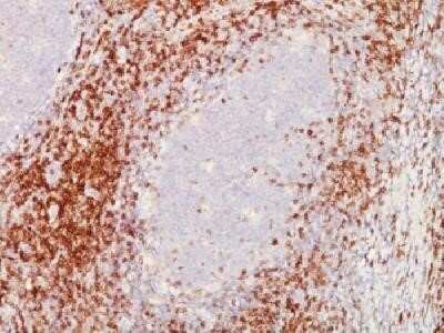 Immunohistochemistry-Paraffin: CD5 Antibody (C5/473 + CD5/54/F6) - Azide and BSA Free [NBP2-34583] - Formalin-fixed paraffin-embedded human tonsil stained with CD5 Monoclonal antibody (C5/473+CD5/54/F6)