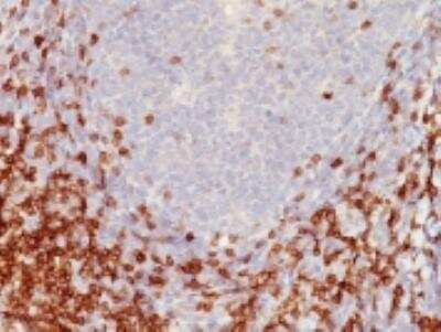 Immunohistochemistry-Paraffin: CD5 Antibody (C5/473) [NBP2-32940] - Formalin-fixed, paraffin-embedded human tonsil stained with CD5 monoclonal antibody (C5/473).