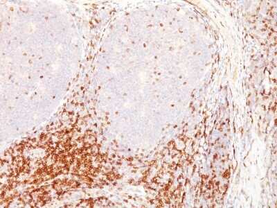 Immunohistochemistry-Paraffin: CD5 Antibody (CD5/54/F6) - Azide and BSA Free [NBP2-34593] - Formalin-fixed, paraffin-embedded human tonsil stained with CD5 MAb (CD5/54/F6)