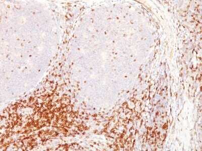 Immunohistochemistry-Paraffin: CD5 Antibody (CD5/54/F6) - IHC-Prediluted [NBP2-44920] - Formalin-fixed, paraffin-embedded human tonsil stained with CD5 MAb (CD5/54/F6)