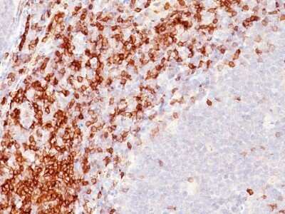 Immunohistochemistry-Paraffin: CD5 Antibody (SPM546) - IHC-Prediluted [NBP2-44919] - Formalin-paraffin tonsil stained with CD5 MAb (SPM546)