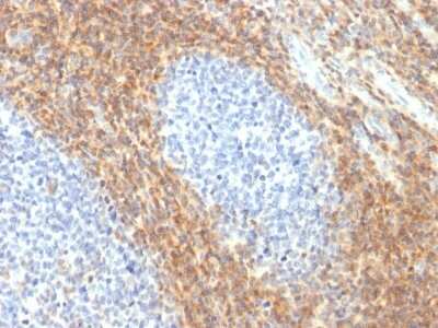 Immunohistochemistry-Paraffin: CD52 Antibody (CD52/2276R) [NBP3-07424] - Formalin-fixed, paraffin-embedded human Tonsil stained with CD52 Rabbit Recombinant Monoclonal Antibody (CD52/2276R).