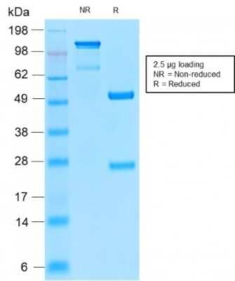 Immunohistochemistry-Paraffin: CD52 Antibody (CD52/2276R) [NBP3-07424] - Formalin-fixed, paraffin-embedded human Tonsil stained with CD52 Rabbit Recombinant Monoclonal Antibody (CD52/2276R).