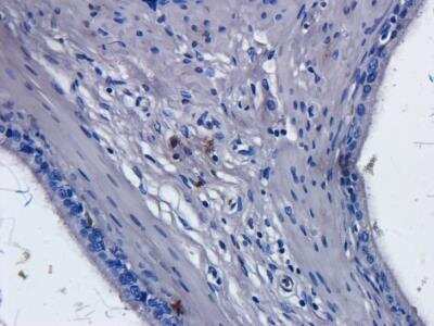 Immunohistochemistry-Paraffin: CD52 Antibody (Campath-1H) [NBP2-52645] - Immunohistochemical staining of rat epididymis tissue using anti-CD52 antibody (NBP2-52645) Campath-1H. Anti-CD52 staining of formaldehyde fixed paraffin embedded rat epididymis tissue, at 40x magnification. The human IgG1-chimeric version of Campath-1H was used to stain samples at a concentration of 5 ug/ml.