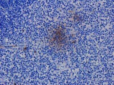 Immunohistochemistry: CD52 Antibody (Campath-1H) [NBP2-52645] - Immunohistochemical staining of rat spleen tissue using anti-CD52 antibody (NBP2-52645) Campath-1H. Anti-CD52 staining of formaldehyde fixed paraffin embedded rat spleen tissue, at 40x magnification. The human IgG1-chimeric version of Campath-1H was used to stain samples at a concentration of 5 ug/ml.