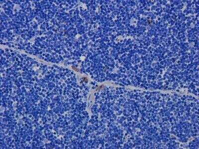 Immunohistochemistry: CD52 Antibody (Campath-1H) [NBP2-75896] - Anti-CD52 staining of formaldehyde fixed paraffin embedded rat thymus tissue, at 40x magnification. The human IgG1-chimeric version of Campath-1H (NBP2-75896) was used to stain samples at a concentration of 5 ug/ml.