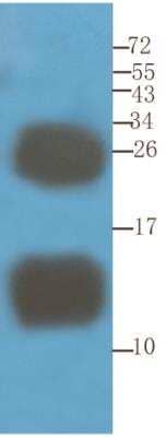 Western Blot: CD52 Antibody (YTH 34.5-G2b (Campath-1G)) [NBP2-75899] - Mouse spleen samples were resolved on a 15% SDS PAGE gel and blots probed with the rat IgG1-chimeric version of YTH 34.5-G2b (NBP2-75899) at 1.5 ug/ml before detection using an anti-rat secondary antibody. Protein was detected by chemiluminescence. The expected unmodified running size for CD52 is ~8kDa, but this protein is extensively glycosylated and exhibits running sizes of ~11-25kDa. NBP2-75899 successfully detected CD52 in mouse spleen samples.