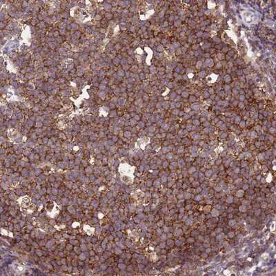 Immunohistochemistry-Paraffin: CD53 Antibody [NBP2-14464] Staining of human tonsil shows strong cytoplasmic positivity in germinal center cells.