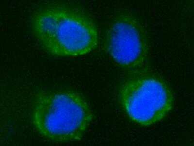 Immunocytochemistry/Immunofluorescence: CD55/DAF Antibody (028) [NBP2-89269] - Staining of Human CD55 in JURKAT cells. Cells were fixed with 4% PFA, blocked with 10% serum, and incubated with Rabbit anti-Human CD55 monoclonal antibody (1:60) at 37c 1 hour. Then cells were stained with the Alexa Fluor(R) 488-conjugated Goat Anti-rabbit IgG secondary antibody (green) and counterstained with DAPI (blue). Positive staining was localized to plasma membrane.