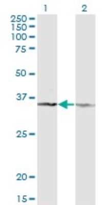 Western Blot: CD58/LFA-3 Antibody (3B12-D5) [H00000965-M02] - Analysis of CD58 expression in transfected 293T cell line by CD58 monoclonal antibody (M02), clone 3B12-D5.Lane 1: CD58 transfected lysate (Predicted MW: 28.1 KDa).Lane 2: Non-transfected lysate.