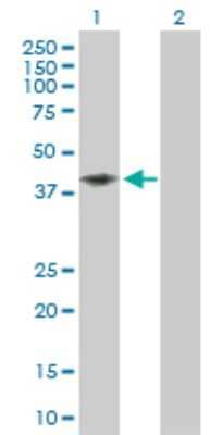Western Blot: CD58/LFA-3 Antibody [H00000965-D01P] - Analysis of CD58 expression in transfected 293T cell line by CD58 polyclonal antibody.Lane 1: CD58 transfected lysate(28.10 KDa).Lane 2: Non-transfected lysate.