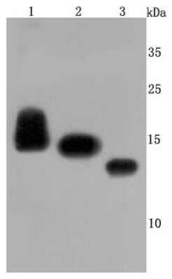 Western Blot: CD59 Antibody (JM10-71) [NBP2-66758] - Analysis of CD59 on different cells lysates using anti-CD59 antibody at 1/500 dilution. Positive control: Lane 1: Human placenta Lane 2: HUVEC Lane 3: K562