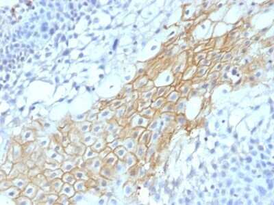 Immunohistochemistry-Paraffin: CD59 Antibody (MACIF/1193) - Azide and BSA Free [NBP2-47822] - Human Tongue stained with CD59 Monoclonal Antibody (MACIF/1193)