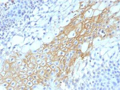 Immunohistochemistry-Paraffin: CD59 Antibody (MACIF/1193) - IHC-Prediluted [NBP2-48467] - Formalin-fixed, paraffin-embedded human Tongue stained with CD59 Monoclonal Antibody (MACIF/1193)