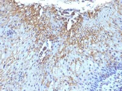 Immunohistochemistry-Paraffin: CD59 Antibody (SPM616) - Azide and BSA Free [NBP2-47821] - Human Tongue stained with CD59 Monoclonal Antibody (SPM616)