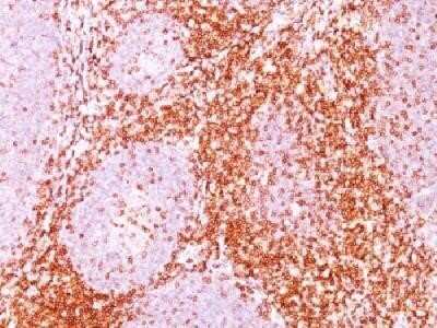 Immunohistochemistry-Paraffin: CD6 Antibody (C6/372) - IHC-Prediluted [NBP2-44554] - Formalin-fixed paraffin-embedded human tonsil stained with CD6 Monoclonal Antibody (C6/372)