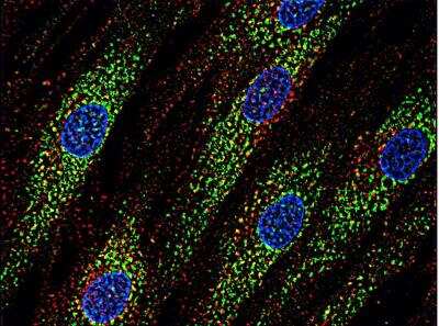 Immunocytochemistry/Immunofluorescence: CD63 Antibody (MEM-259) [FITC] [NB500-483] - Human skin fibroblasts with anti-CD63 (MEM-259; green) after co-incubation of living cells with human Transferrin - Dyomics 547 (cat. no. TFD547; red); cell nuclei stained with DAPI (blue). 