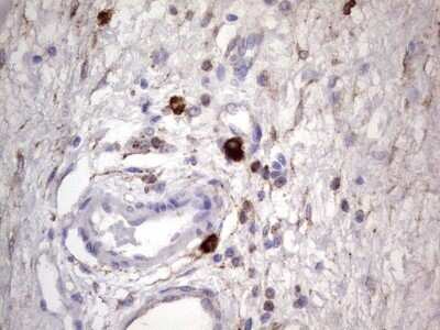 Immunohistochemistry: CD63 Antibody (OTI5E5) - Azide and BSA Free [NBP2-70380] - Analysis of Human bladder tissue. (Heat-induced epitope retrieval by 1 mM EDTA in 10mM Tris, pH8.5, 120C for 3min)