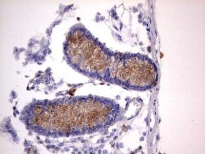 Immunohistochemistry: CD63 Antibody (OTI5E5) - Azide and BSA Free [NBP2-70380] - Analysis of Human colon tissue. (Heat-induced epitope retrieval by 1 mM EDTA in 10mM Tris, pH8.5, 120C for 3min)