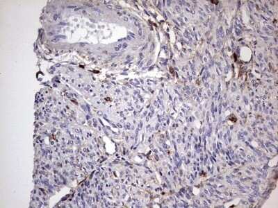 Immunohistochemistry: CD63 Antibody (OTI5E5) - Azide and BSA Free [NBP2-70380] - Analysis of Human endometrium tissue. (Heat-induced epitope retrieval by 1 mM EDTA in 10mM Tris, pH8.5, 120C for 3min)