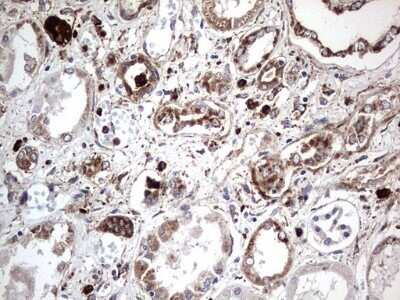 Immunohistochemistry: CD63 Antibody (OTI5E5) - Azide and BSA Free [NBP2-70380] - Analysis of Human Kidney tissue. (Heat-induced epitope retrieval by 1 mM EDTA in 10mM Tris, pH8.5, 120C for 3min)