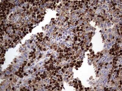 Immunohistochemistry: CD63 Antibody (OTI5E5) - Azide and BSA Free [NBP2-70380] - Analysis of Human lymph node tissue. (Heat-induced epitope retrieval by 1 mM EDTA in 10mM Tris, pH8.5, 120C for 3min)