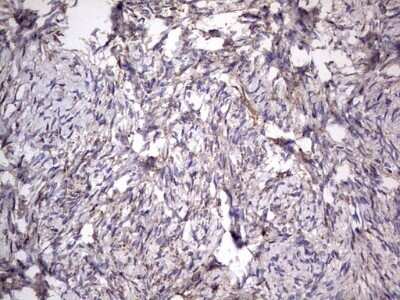 Immunohistochemistry: CD63 Antibody (OTI5E5) - Azide and BSA Free [NBP2-70380] - Analysis of Human Ovary tissue. (Heat-induced epitope retrieval by 1 mM EDTA in 10mM Tris, pH8.5, 120C for 3min)