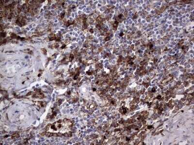 Immunohistochemistry: CD63 Antibody (OTI5E5) - Azide and BSA Free [NBP2-70380] - Analysis of Human tonsil within the normal limits using CD63 mouse monoclonal antibody. (Heat-induced epitope retrieval by 1 mM EDTA in 10mM Tris, pH8.5, 120C for 3min)