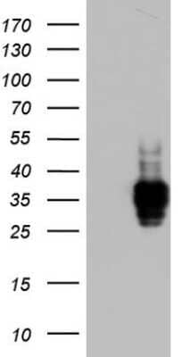 Western Blot: CD63 Antibody (OTI5E5) - Azide and BSA Free [NBP2-70380] - Analysis of HEK293T cells were transfected with the pCMV6-ENTRY control (Left lane) or pCMV6-ENTRY CD63 .