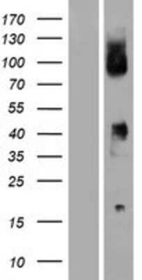 Western Blot: CD64 Overexpression Lysate (Adult Normal) [NBP2-10606] Left-Empty vector transfected control cell lysate (HEK293 cell lysate); Right -Over-expression Lysate for CD64.