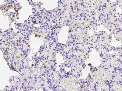 Immunohistochemistry-Paraffin: CD68/SR-D1 Antibody (001) [NBP2-90914] - Staining of rat CD68/SR-D1 in rat lung with rabbit monoclonal antibody (1:2000).