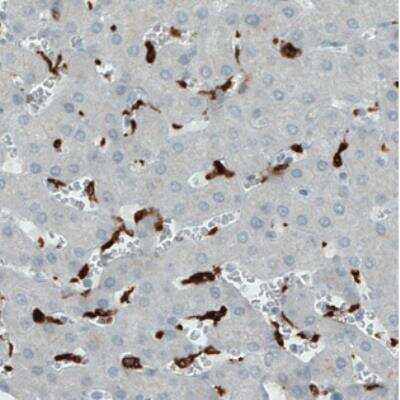 Immunohistochemistry: CD68/SR-D1 Antibody (CL1338) [NBP2-34481] - Staining of human liver shows strong immunoreactivity in Kupffer cells.