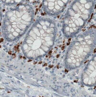 Immunohistochemistry: CD68/SR-D1 Antibody (CL1338) [NBP2-34481] - Staining of human colon shows strong positivity in a subset of lymphoid cells.