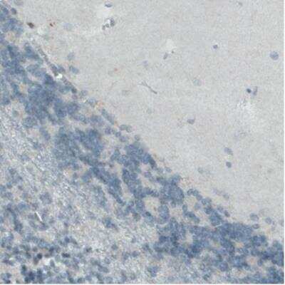 Immunohistochemistry: CD68/SR-D1 Antibody (CL1338) [NBP2-34481] - Staining of human cerebellum shows absence of immunoreactivity (negative control).
