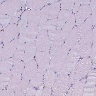 Immunohistochemistry-Paraffin: CD68/SR-D1 Antibody [NBP2-48923] - Immunohistochemical staining of human skeletal muscle shows no positivity as expected.