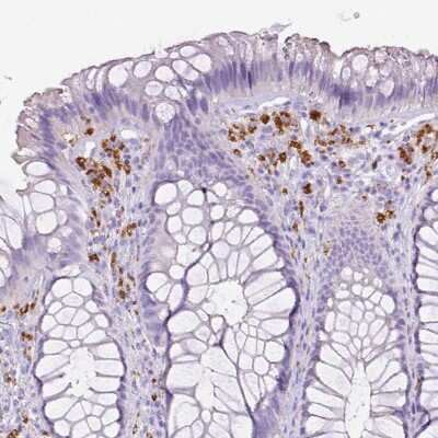 Immunohistochemistry-Paraffin: CD68/SR-D1 Antibody [NBP2-48923] - Immunohistochemical staining of human rectum shows strong cytoplasmic positivity in tissue macrophages.