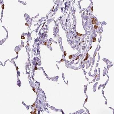 <b>Genetic Strategies Validation. </b>Immunohistochemistry-Paraffin: CD68/SR-D1 Antibody [NBP2-48923] - Immunohistochemical staining of human lung shows strong cytoplasmic positivity in macrophages.