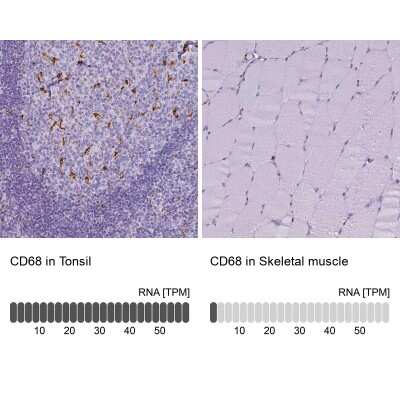 <b>Orthogonal Strategies Validation. </b>Immunohistochemistry-Paraffin: CD68/SR-D1 Antibody [NBP2-48923] - Staining in human tonsil and skeletal muscle tissues . Corresponding CD68 RNA-seq data are presented for the same tissues.